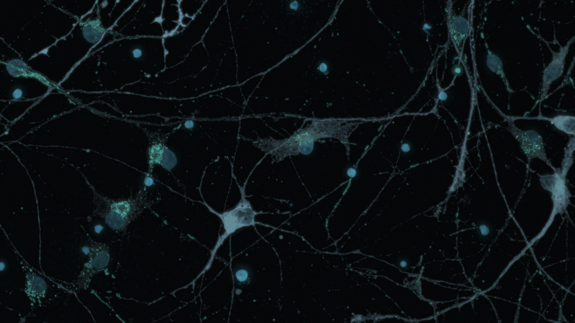 An image of neurons from Nine Square Therapeutics